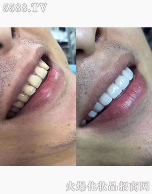 ��(y��ng)������Ӗ(x��n)����