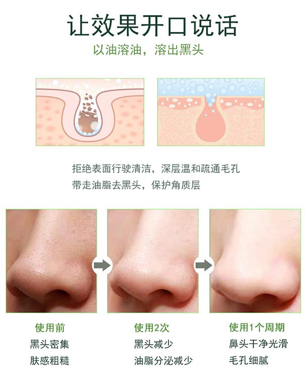 Ԋ(sh��)�����(sh��)ȥ���^�o(h��)�����b