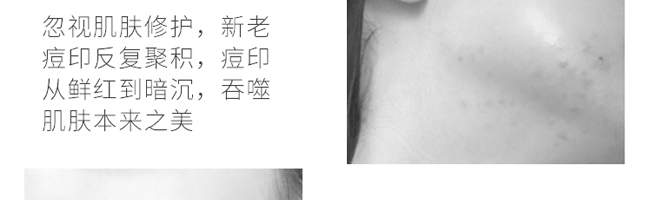 ������ֲ������AҺ