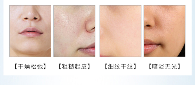 ��������o���A���