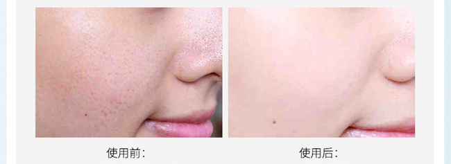 ��������o���A���