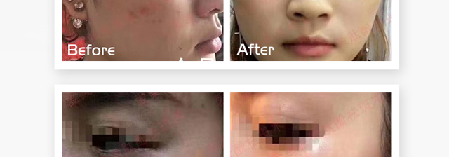 ΢�ķ����o(h��)ԭҺ