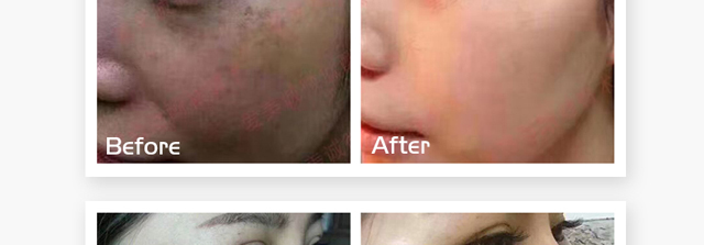 ΢�ķ����o(h��)ԭҺ