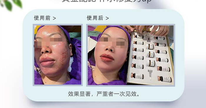 萌娜塔草本凈膚套裝 萌娜塔草本凈膚套裝