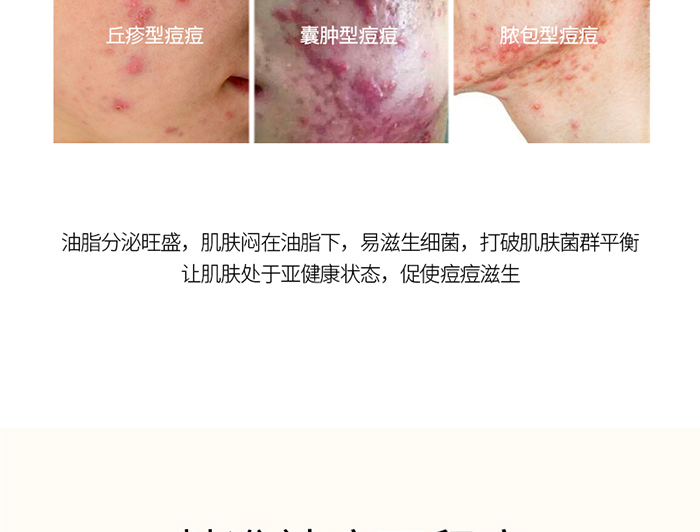 Ԕ��-ֲ��ƽ��ˮ