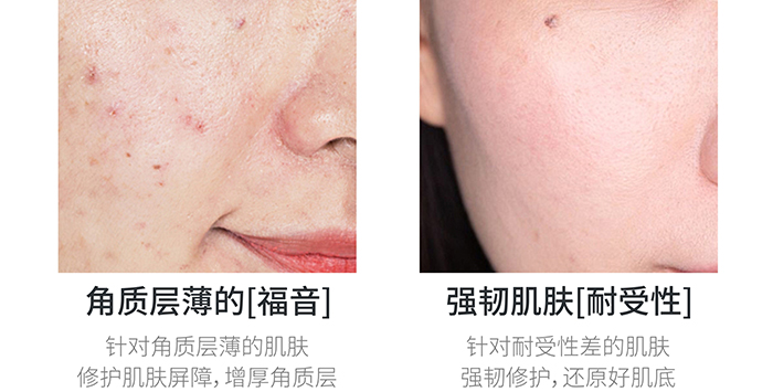 高地保濕修護(hù)霜 高地保濕修護(hù)霜